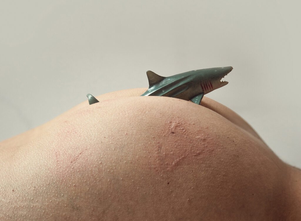 Shark attack