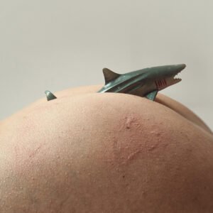 Shark attack